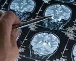A new variation of MRI – called DIANA or direct imaging of neuronal activity – hopes to track the propagation of brain signals on millisecond timescales